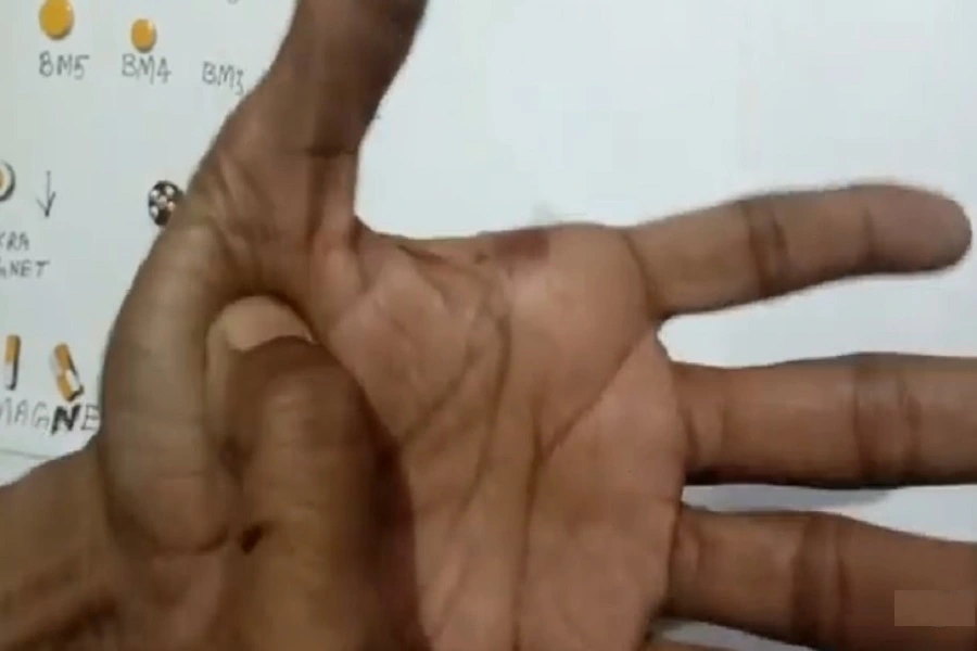 Sujok Therapy Course Hindi – एक्यूप्रेशर और मैग्नेट थेरेपी प्रशिक्षण