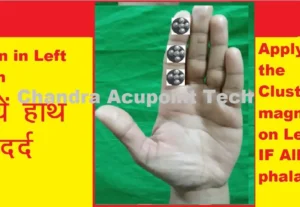 Left hand pain treatment using cluster magnet in acupressure therapy